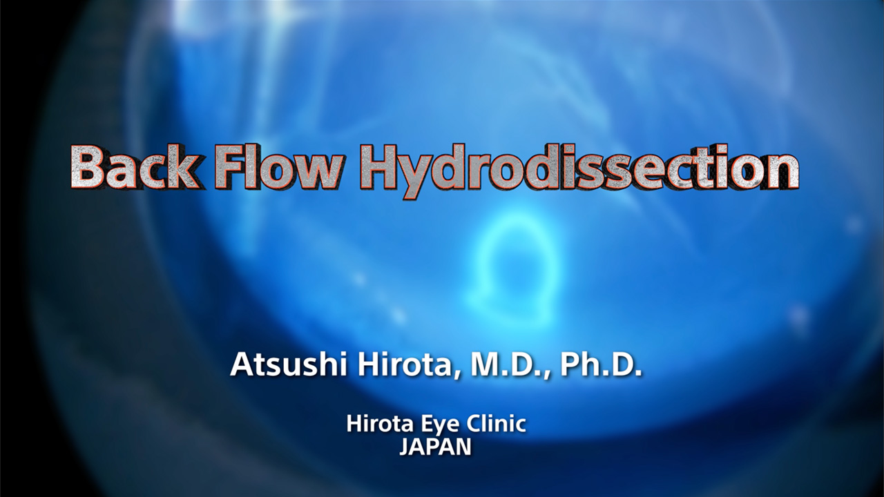 Back Flow Hydrodissection