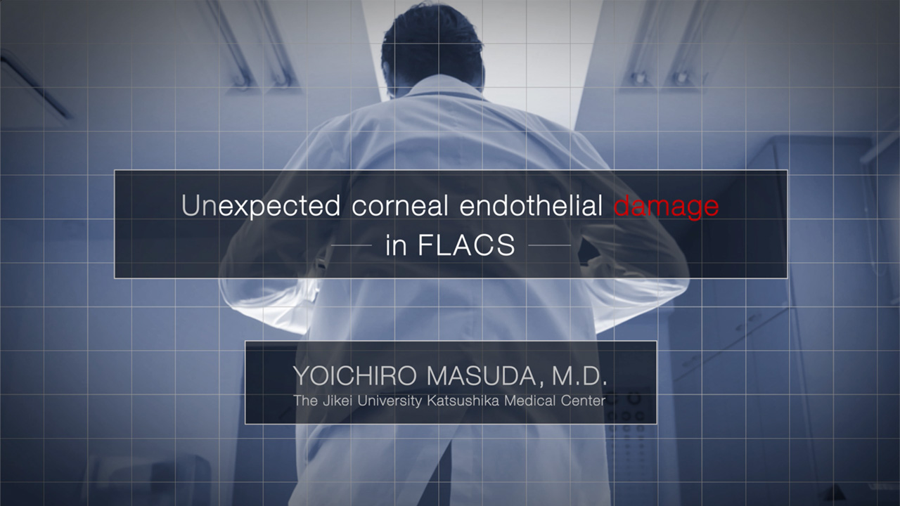 Unexpected Corneal Endothelial Damage in FLACS