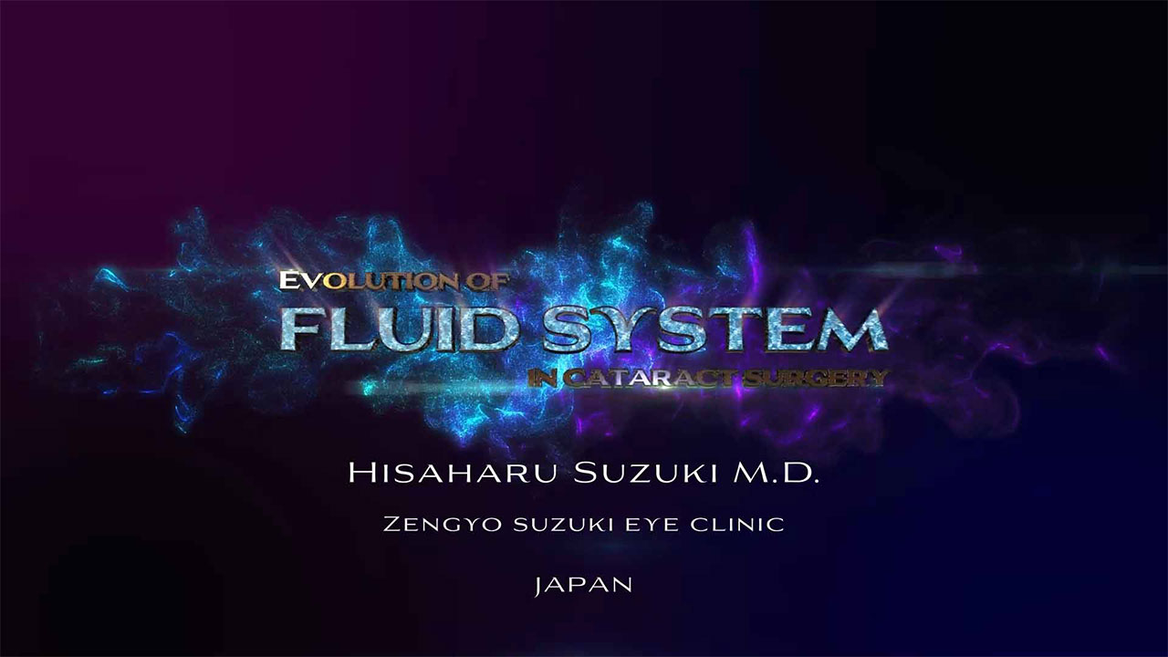 Evolution of Fluid System in Cataract Surgery