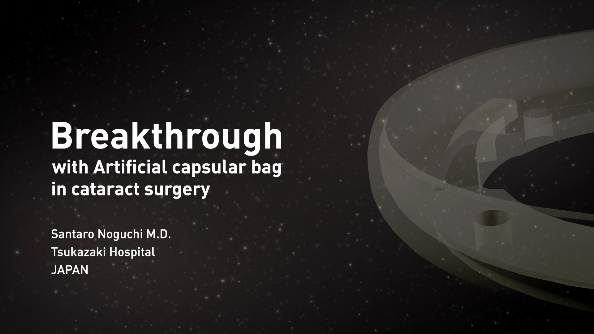 Breakthrough with Artificial capsular bag in cataract surgery