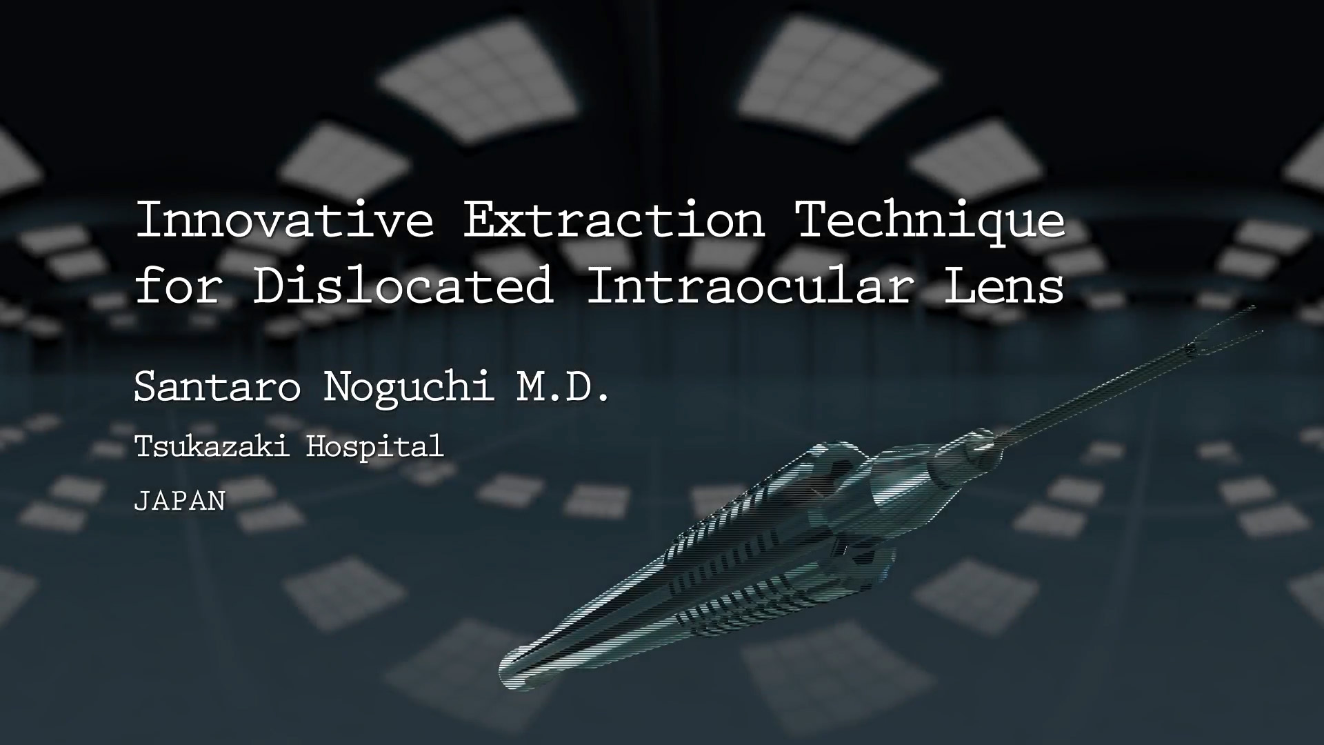 Innovative Extraction Technique for Dislocated Intraocular Lens