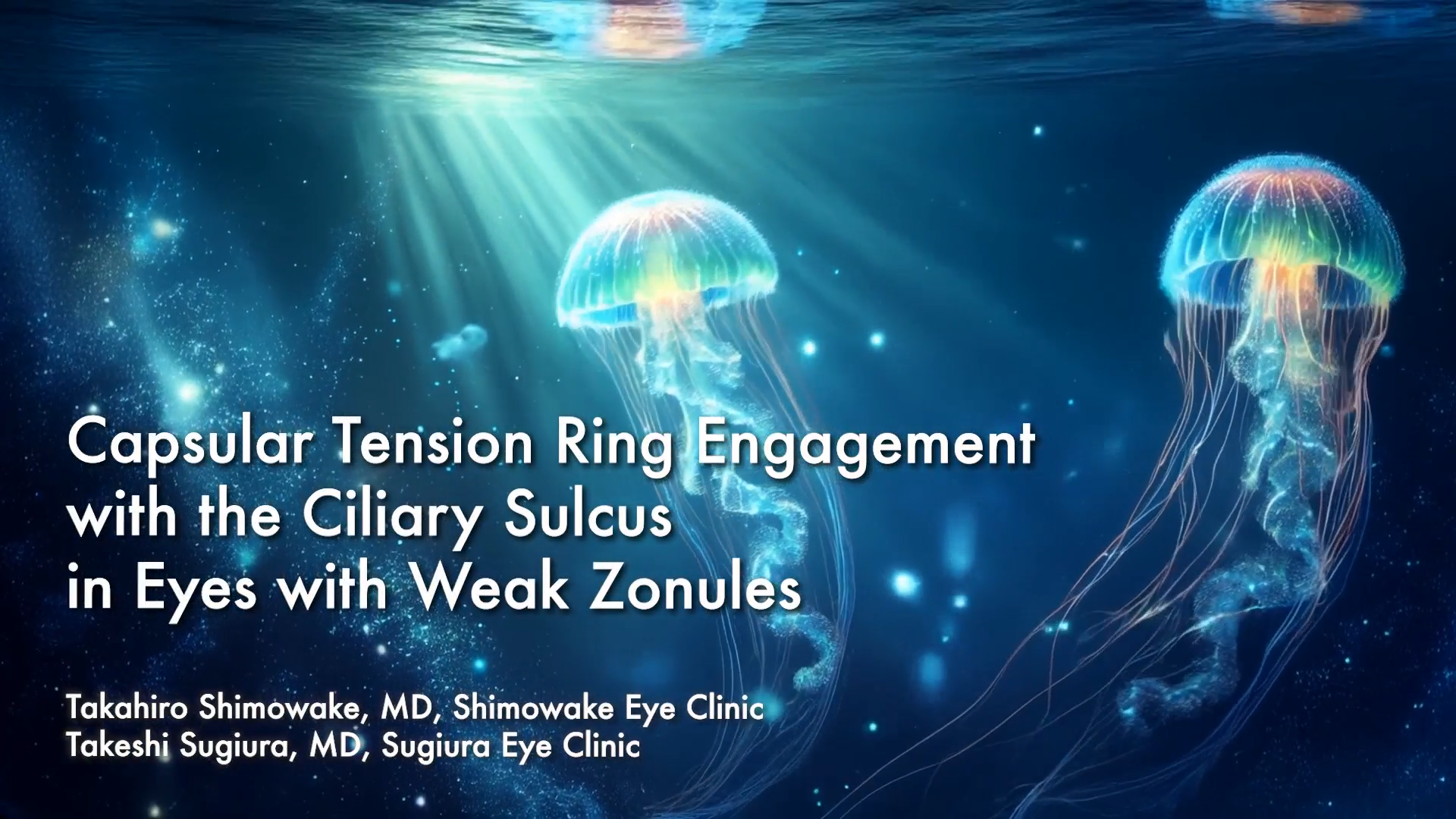 Capsular tension ring engagement with the ciliary sulcus in eyes with weak zonules